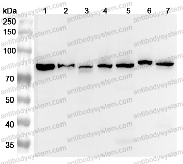 Anti-Human AFG3L2 Polyclonal Antibody