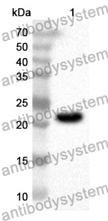 Anti-Human COQ7 Polyclonal Antibody