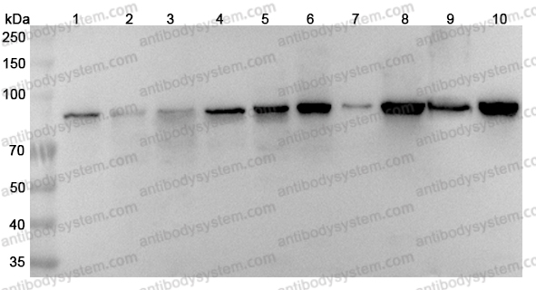 Anti-Human DDX1 Polyclonal Antibody