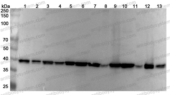 Anti-Human DNAJB11 Polyclonal Antibody