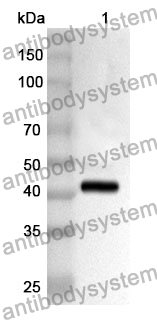 Anti-Human KIF15 Polyclonal Antibody