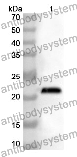 Anti-Human NDUFA4L2 Polyclonal Antibody