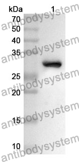 Anti-Human UHRF1 Polyclonal Antibody