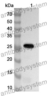 Anti-Human UHRF1 Polyclonal Antibody