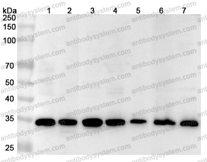 Anti-Human STUB1 Polyclonal Antibody