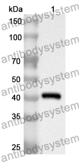 Anti-Human AGTPBP1 Polyclonal Antibody