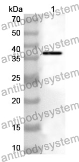 Anti-Human DIAPH3 Polyclonal Antibody