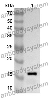 Anti-Human MARCHF8 Polyclonal Antibody