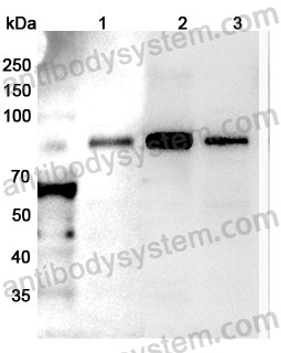 Anti-Human RHOT2 Polyclonal Antibody