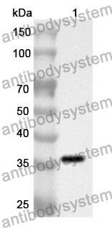 Anti-Human NLRX1 Polyclonal Antibody