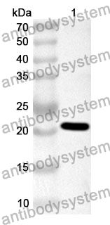 Anti-Human RASSF6 Polyclonal Antibody