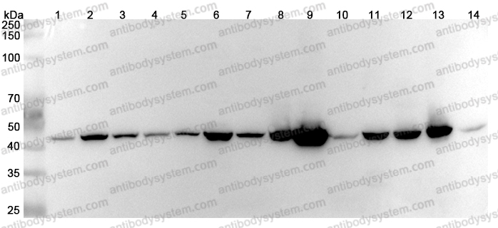 Anti-Human SUCLA2 Polyclonal Antibody