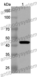 Anti-Human ARHGEF25 Polyclonal Antibody