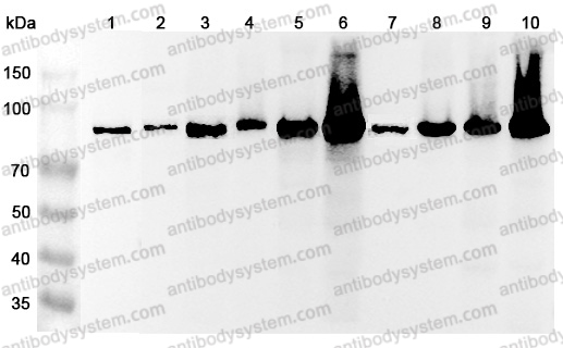 Anti-Human ACO2 Polyclonal Antibody