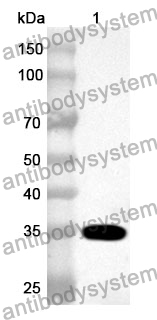 Anti-Human ING2 Polyclonal Antibody