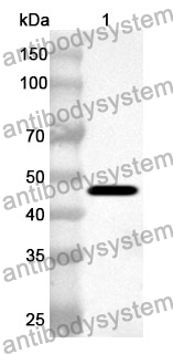 Anti-Human L2HGDH Polyclonal Antibody