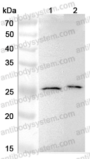 Anti-Human MAD2L2 Polyclonal Antibody