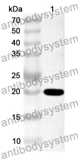 Anti-Human MLPH Polyclonal Antibody