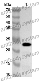 Anti-Human RAB18 Polyclonal Antibody