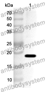 Anti-Human ITCH Polyclonal Antibody