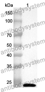 Anti-Human ROBO1 Polyclonal Antibody