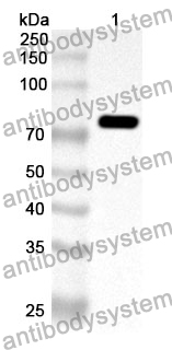 Anti-Human VPS33B Polyclonal Antibody