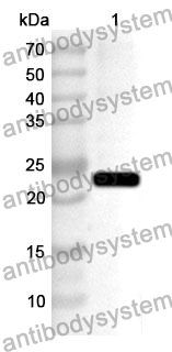 Anti-Human TRIM31 Polyclonal Antibody