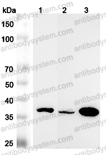 Anti-Human MRPL45 Polyclonal Antibody