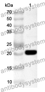 Anti-Human KATNB1 Polyclonal Antibody