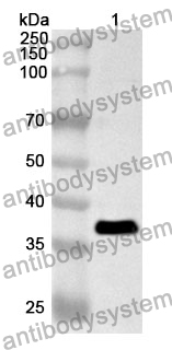 Anti-Human POT1 Polyclonal Antibody