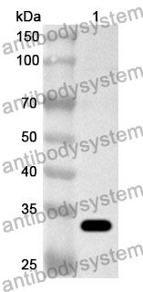 Anti-Human ZFYVE27 Polyclonal Antibody