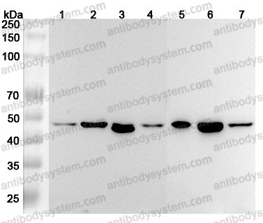 Anti-Human RSAD2 Polyclonal Antibody