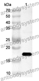 Anti-Human SPAG5 Polyclonal Antibody