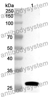 Anti-Human RICTOR Polyclonal Antibody