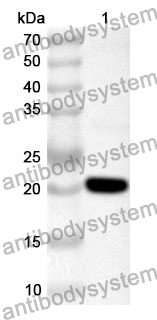 Anti-Human CHMP2B Polyclonal Antibody