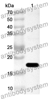 Anti-Human DIO2 Polyclonal Antibody