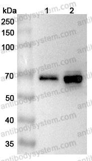 Anti-Human EIF2B4 Polyclonal Antibody