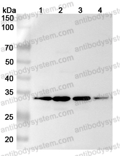 Anti-Human METTL1 Polyclonal Antibody