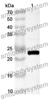 Anti-Human QKI Polyclonal Antibody