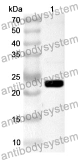 Anti-Human RAB8B Polyclonal Antibody