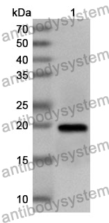 Anti-Human NPRL2 Polyclonal Antibody