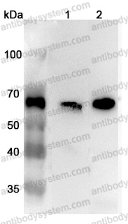 Anti-Human CARM1 Polyclonal Antibody