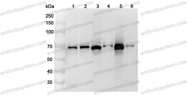 Anti-Human DARS2 Polyclonal Antibody