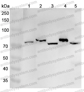 Anti-Human EXOC7 Polyclonal Antibody