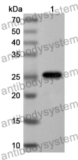 Anti-Human SUV39H2 Polyclonal Antibody