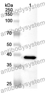 Anti-Human ZC3H4 Polyclonal Antibody