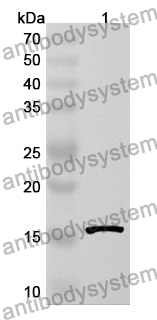 Anti-Human CEP72 Polyclonal Antibody