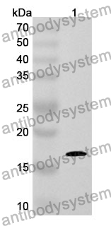 Anti-Human KRT80 Polyclonal Antibody