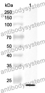 Anti-Human NRDE2 Polyclonal Antibody