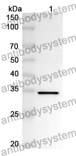 Anti-Human ROGDI Polyclonal Antibody